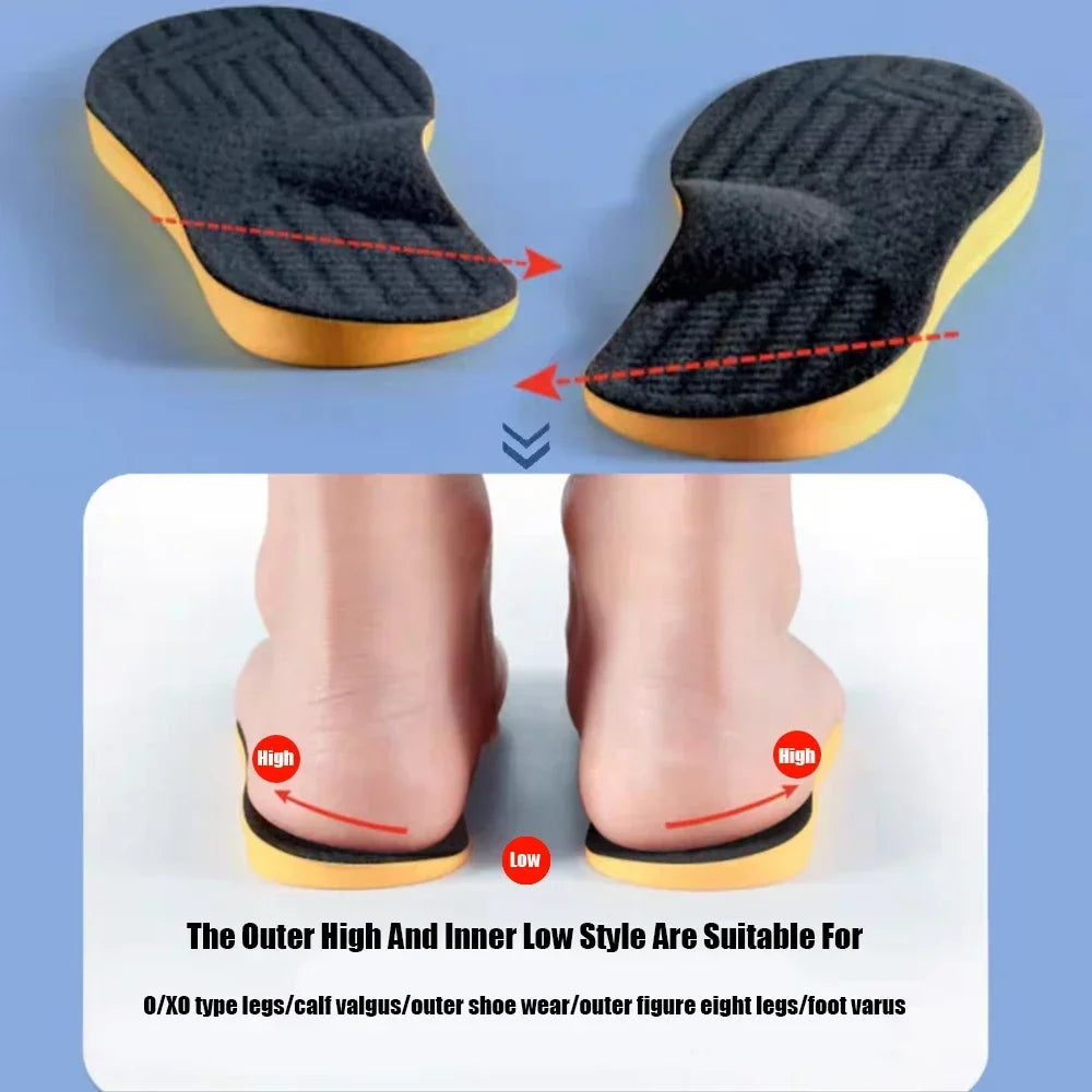 ArchRelief™ – Orthopedic Insoles Arch Support Insole for Flat Feet O/X-Leg Plantar 2