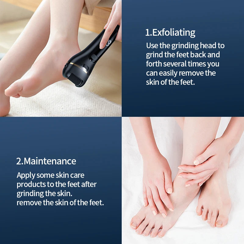 SmoothStep™ – Rechargeable Electric Foot Grinder - USB Powered Callus Remover with 4