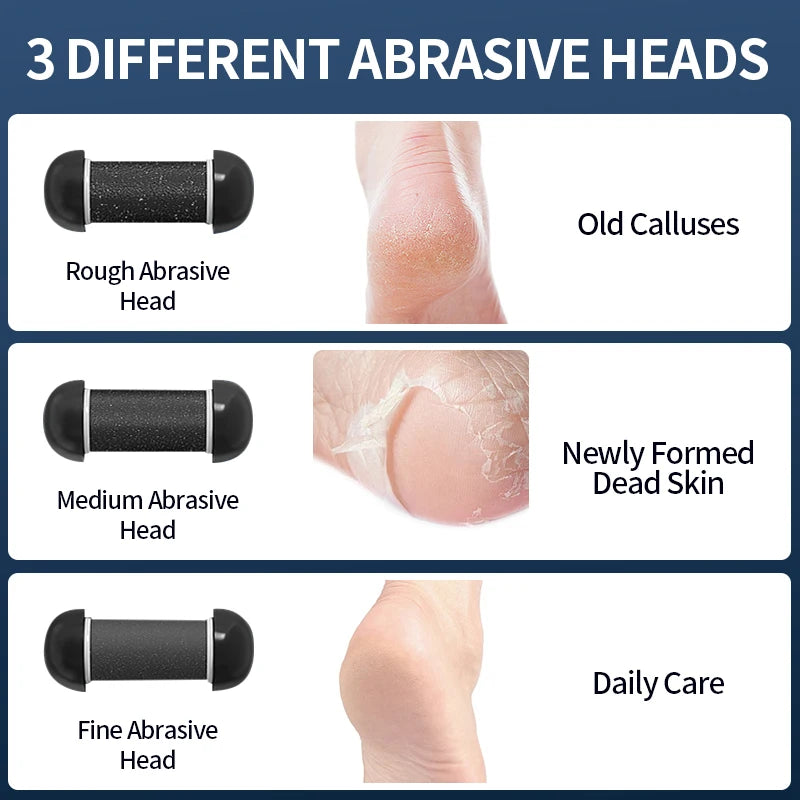 SmoothStep™ – Rechargeable Electric Foot Grinder - USB Powered Callus Remover with 5