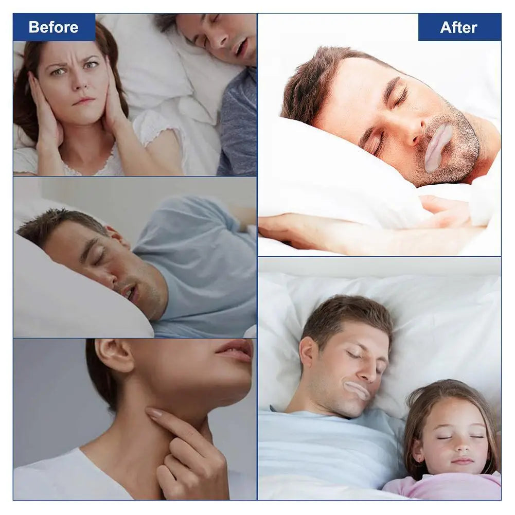DreamSeal™ – Gentle Sleep Mouth Tape for Nasal Breathing & Snore-Free Nights (90 Strips)